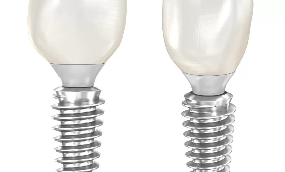 Ekonomik İmplantı Nasıl Yaptırabilirim