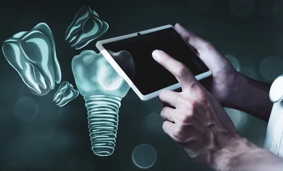 Diş İmplantı Kimlere Uygulanır?