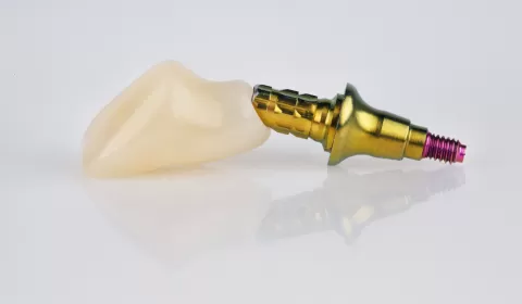 Terminology In Implant Dentistry