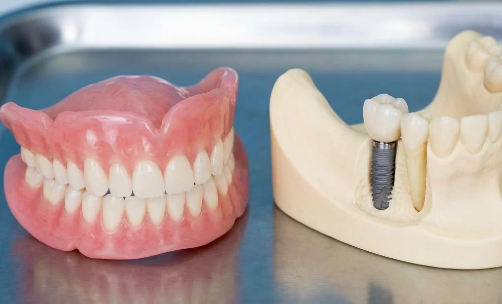 Protez Kullanmanın Çene Kemiğine Zararları