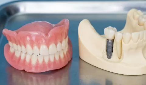 Protez Kullanmanın Çene Kemiğine Zararları