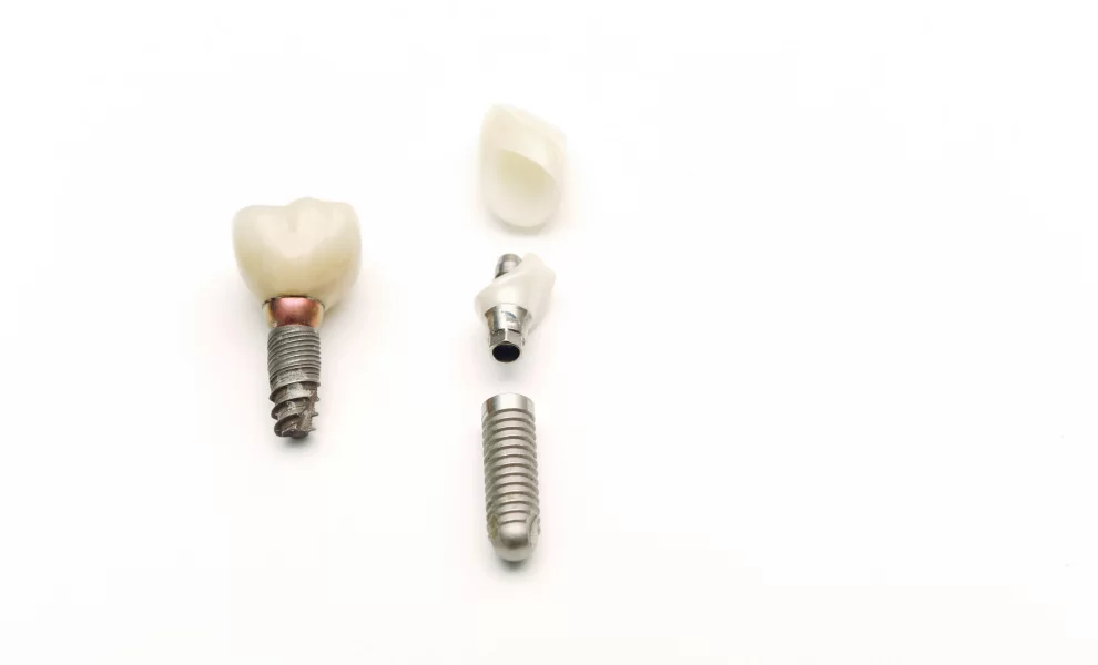 Diş İmplantları Ve İmplant Parçaları