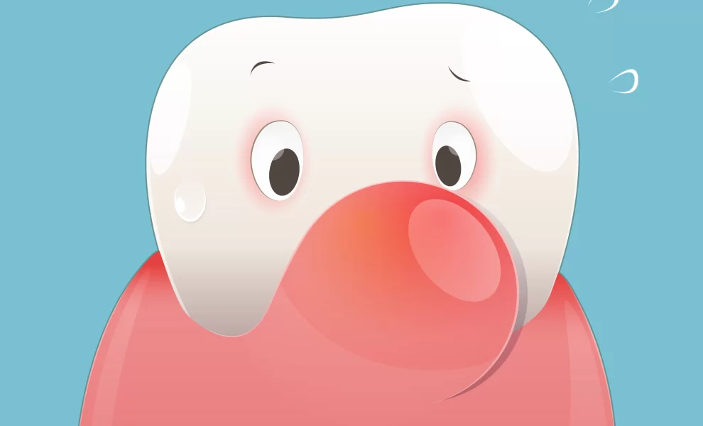 İmplant Sonrası Ağrı Ve Şişlik: Ne Normal Mi ?