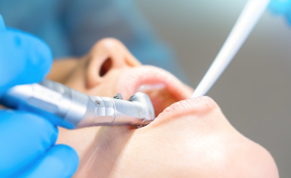 1 Günde Hemen İmplant (immediate)Tedavisi