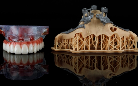 Subperiostal (Kişiye Özel) İmplant Tedavisi